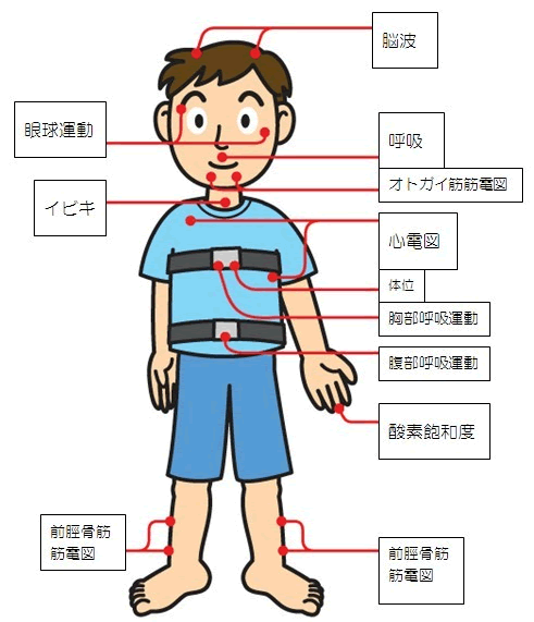 終夜睡眠ポリグラフィー検査で装着するセンサー